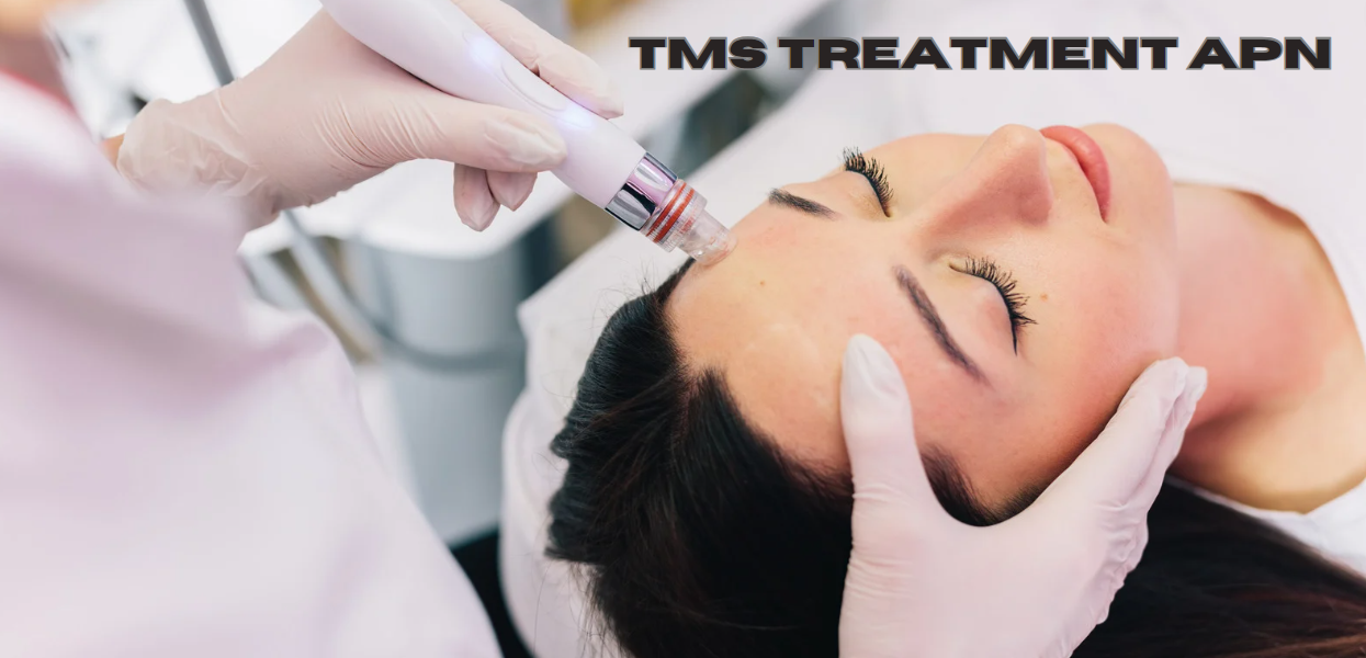 TMS Treatment APN