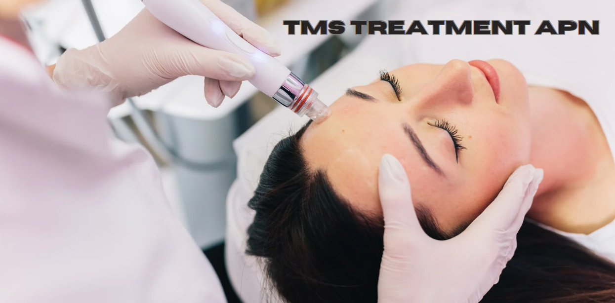 TMS Treatment APN